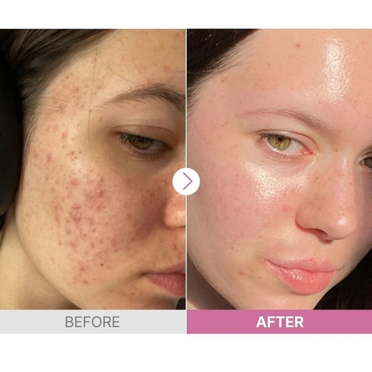 Radiant Glow Skin Cream