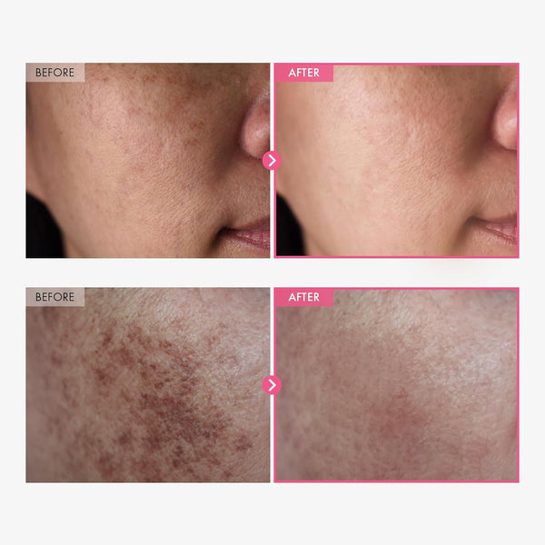 Radiant Glow Skin Cream