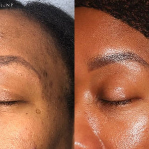 Emily Rockwell on Instagram_ _my tips for treating….jpeg