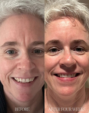 Potent vegan daily treatment for plumper, firmer….jpeg