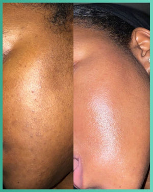 Want to know how to get smoother, brighter skin_… (1).jpeg